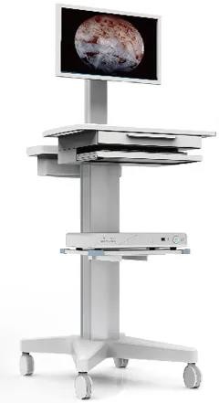 上虞三院,妇科,微创技术