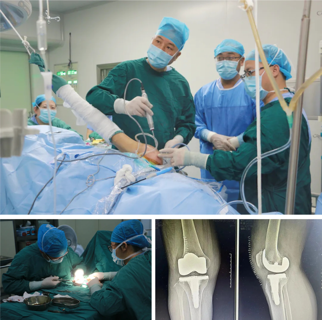 上虞第三医院,骨科,医生